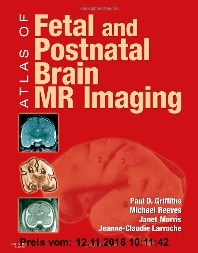 Gebr. - Atlas of Fetal and Postnatal Brain MR