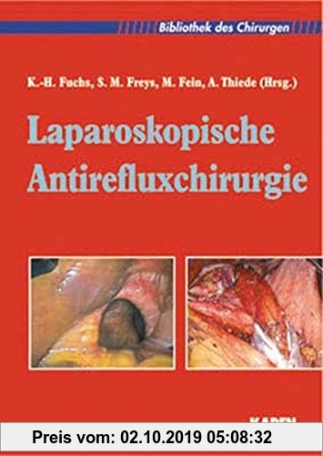 Gebr. - Laparoskopische Antirefluxchirurgie (Bibliothek des Chirurgen)