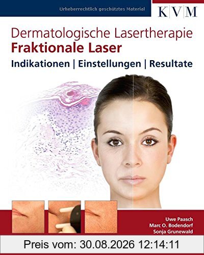 Dermatologische Lasertherapie Band 1: Fraktionale Laser: Indikationen - Einstellungen - Resultate