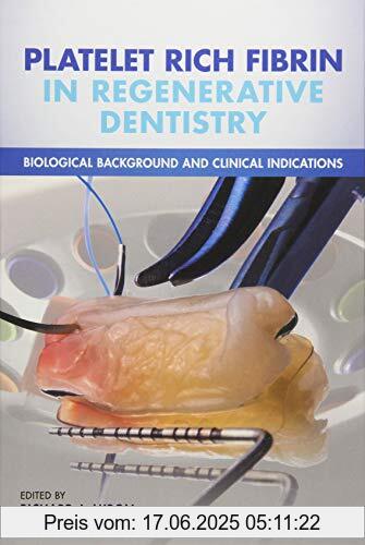 Binding : Gebundene Ausgabe, Edition : 1, Label : BLACKWELL PUBL, Publisher : BLACKWELL PUBL, medium : Gebundene Ausgabe, numberOfPages : 288, publicationDate : 2017-09-12, publishers : Miron, Richard J., Joseph Choukroun, ISBN : 1119406811