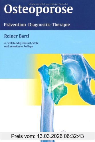 Reiner Bartl Osteoporose, Prävention - Diagnostik - Therapie