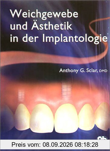 Weichgewebe und Ästhetik in der Implantologie