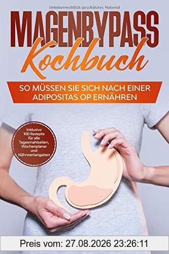 Magenbypass Kochbuch: So müssen Sie sich nach einer Adipositas OP ernähren - Inklusive 100 Rezepte für alle Tagesmahlzeiten, Wochenplaner und Nährwertangaben
