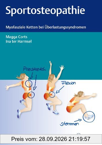 Sportosteopathie: Myofasziale Ketten bei Überlastungssyndromen
