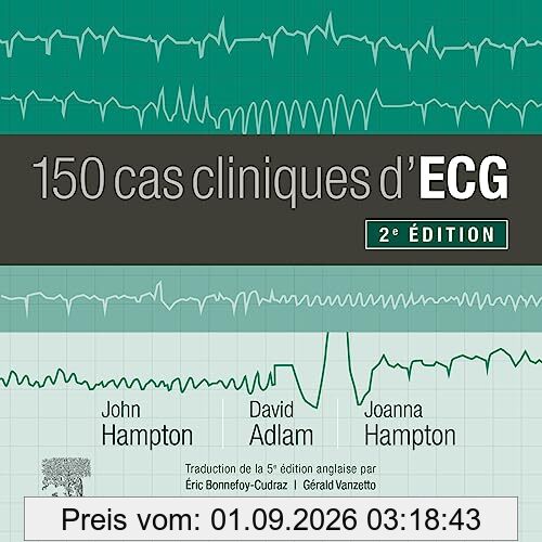 150 cas cliniques d'ECG