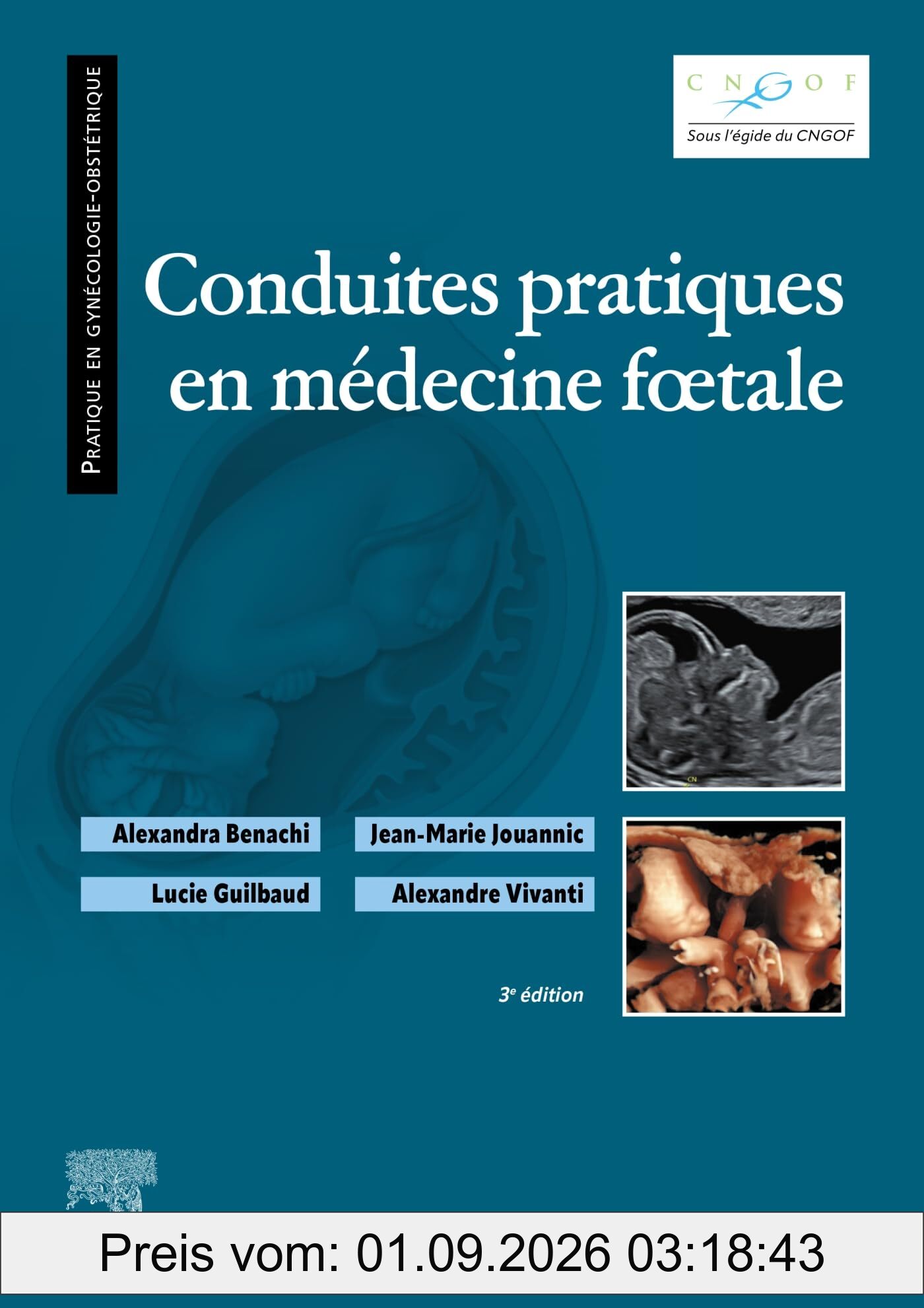 Conduites pratiques en médecine foetale