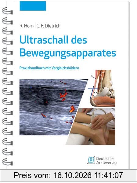 Ultraschall des Bewegungsapparates: Praxishandbuch mit Vergleichsbildern