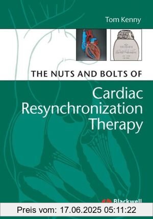 Binding : Taschenbuch, Edition : 1. Auflage, Label : Wiley-Blackwell, Publisher : Wiley-Blackwell, medium : Taschenbuch, numberOfPages : 226, publicationDate : 2007-04-26, authors : Tom Kenny, languages : english, ISBN : 1405153725