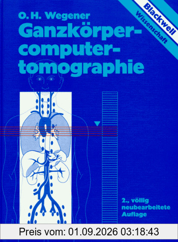 Ganzkörpercomputertomographie