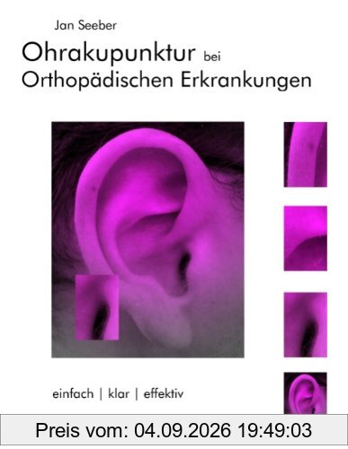 Ohrakupunktur bei Orthopädischen Erkrankungen: Balancierte Ohrakupunktur: einfach, klar, effektiv