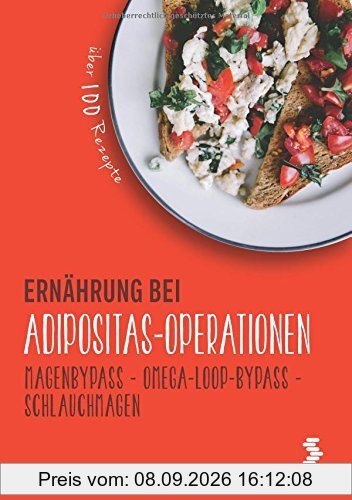 Ernährung bei Adipositas-Operationen: Magenbypass - Omega-Loop-Bypass - Schlauchmagen (maudrich.gesund essen)