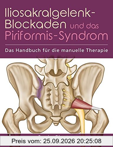 Iliosakralgelenk-Blockaden und das Piriformis-Syndrom: Das Handbuch für die manuelle Therapie