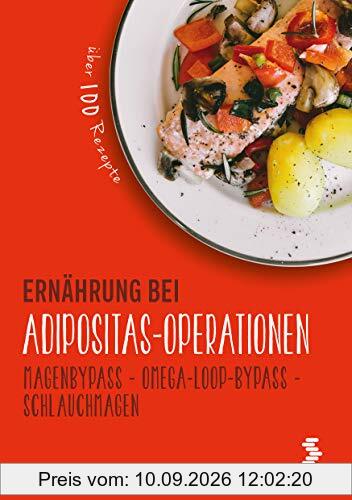 Ernährung bei Adipositas-Operationen: Magenbypass - Omega-Loop-Bypass - Schlauchmagen (maudrich.gesund essen)