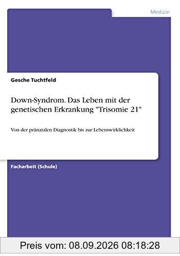 Down-Syndrom. Das Leben mit der genetischen Erkrankung Trisomie 21: Von der pränatalen Diagnostik bis zur Lebenswirklichkeit