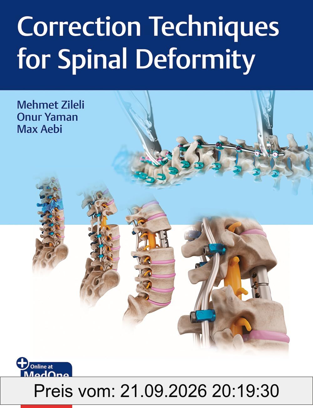 Correction Techniques for Spinal Deformity