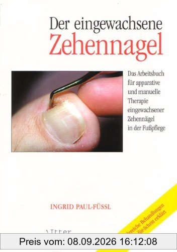Der eingewachsene Zehennagel Das Arbeitsbuch für apparative und manuelle Therapie eingewachsener Zehennägel in der Fußpflege