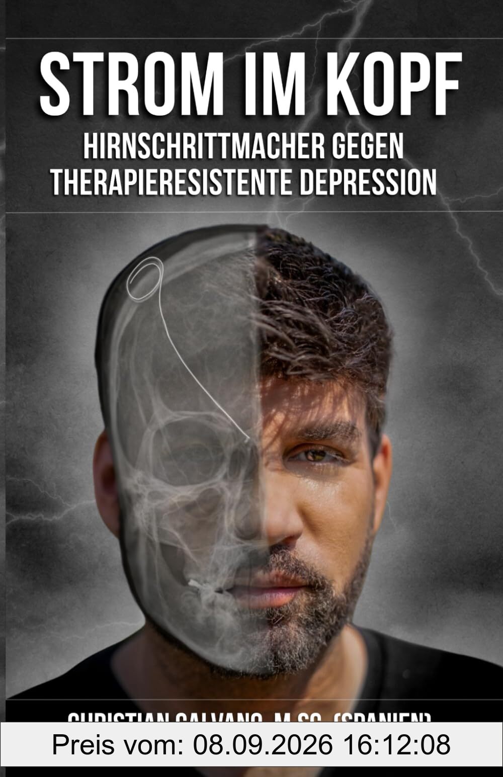Strom im Kopf: Hirnschrittmacher gegen therapieresistente Depression