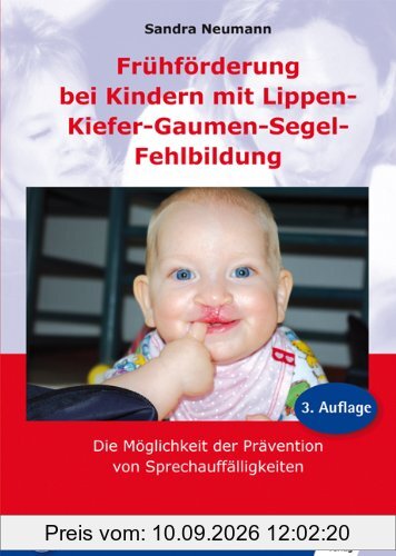 Frühförderung bei Kindern mit Lippen-Kiefer-Gaumen-Segel-Fehlbildung