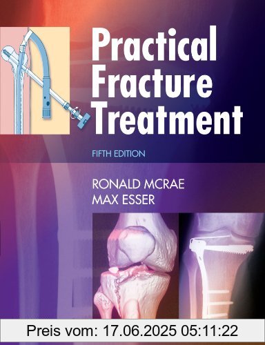 Binding : Taschenbuch, Edition : 5, Label : Churchill Livingstone, Publisher : Churchill Livingstone, medium : Taschenbuch, numberOfPages : 456, publicationDate : 2008-04-08, authors : Ronald McRae, languages : english, ISBN : 0443068763