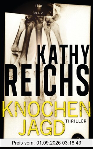 Knochenjagd