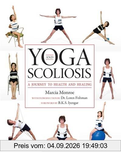 Yoga and Scoliosis: A Journey to Health and Healing