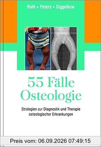 55 Fälle Osteologie
