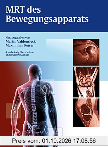 MRT des Bewegungsapparats