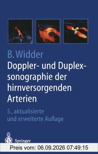 Doppler- und Duplexsonographie der hirnversorgenden Arterien
