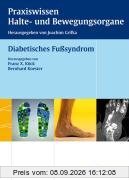 Diabetisches Fußsyndrom. Praxiswissen Halte- und Bewegungsorgane