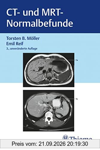 CT und MRT Normalbefunde