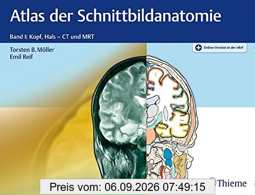 Atlas der Schnittbildanatomie: Band I: Kopf, Hals