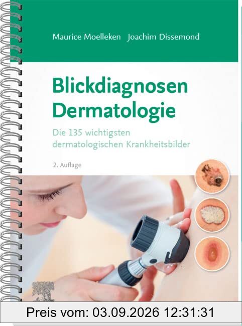 Blickdiagnosen Dermatologie: Die 135 wichtigsten dermatologischen Krankheitsbilder