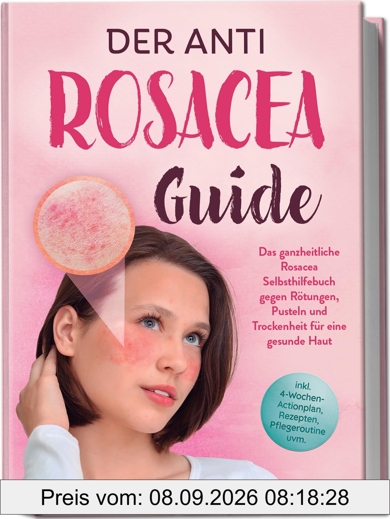 Der Anti Rosacea Guide: Das ganzheitliche Rosacea Selbsthilfebuch gegen Rötungen, Pusteln und Trockenheit für eine gesunde Haut - inkl. 4‑Wochen‑Actionplan, Rezepten, Pflegeroutine uvm.