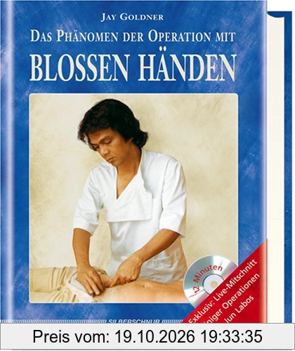 Das Phänomen der Operation mit blossen Händen, m. DVD