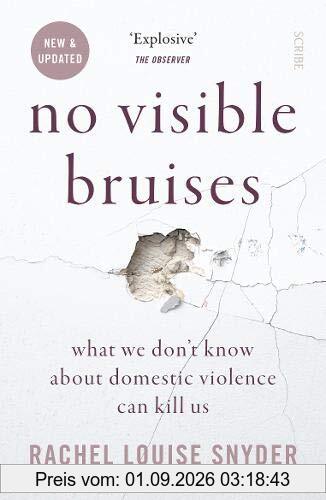 Snyder, R: No Visible Bruises