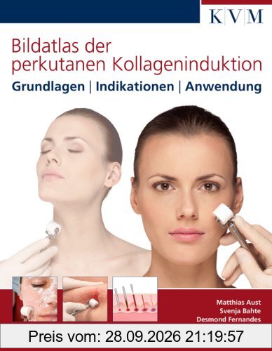 Bildatlas der perkutanen Kollageninduktion: Grundlagen | Indikationen | Anwendung