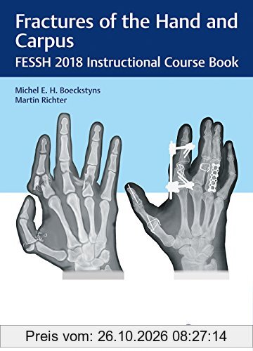 Fractures of the Hand and Carpus: FESSH 2018 Instructional Course Book
