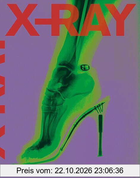 X-RAY