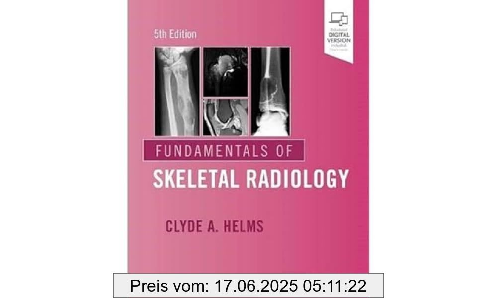 Brand : Elsevier, Binding : paperback, Edition : 5, Label : Fundamentals of Skeletal Radiology, NumberOfItems : 1, PackageQuantity : 1, medium : paperback, numberOfPages : 272, publicationDate : 2019-02-21, releaseDate : 2019-02-21, languages : english, ISBN : 0323611656