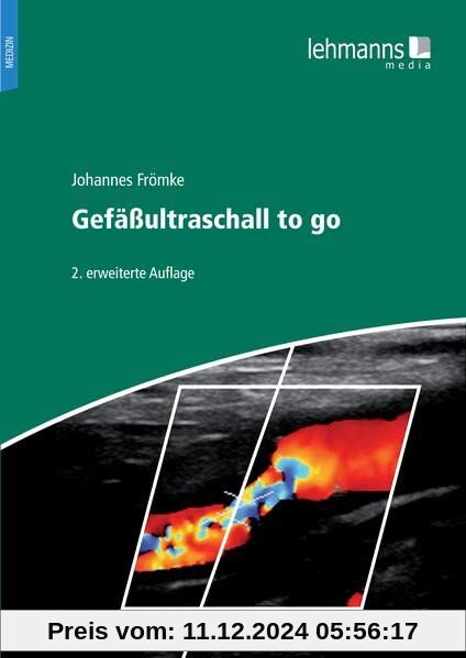 Gefäßultraschall to go