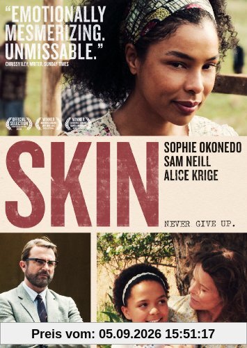 Skin [DVD] [2008] [UK Import]