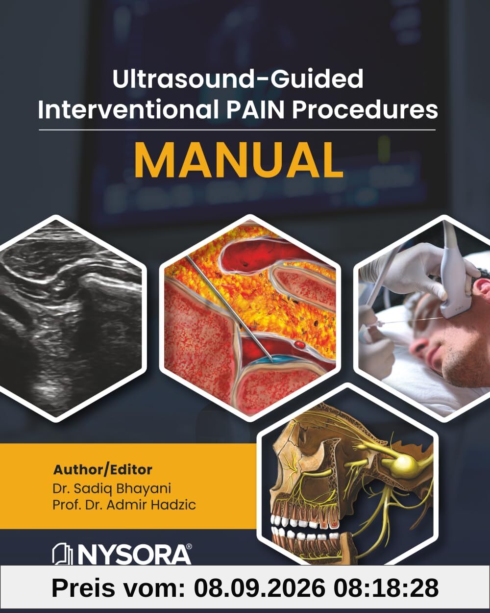 Ultrasound-Guided Interventional Pain Procedures Manual