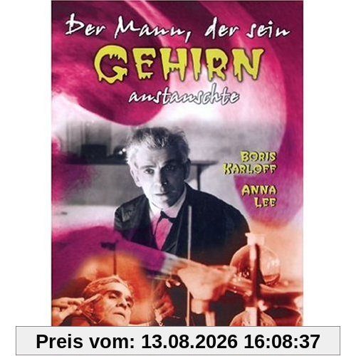 Der Mann, der sein Gehirn austauschte