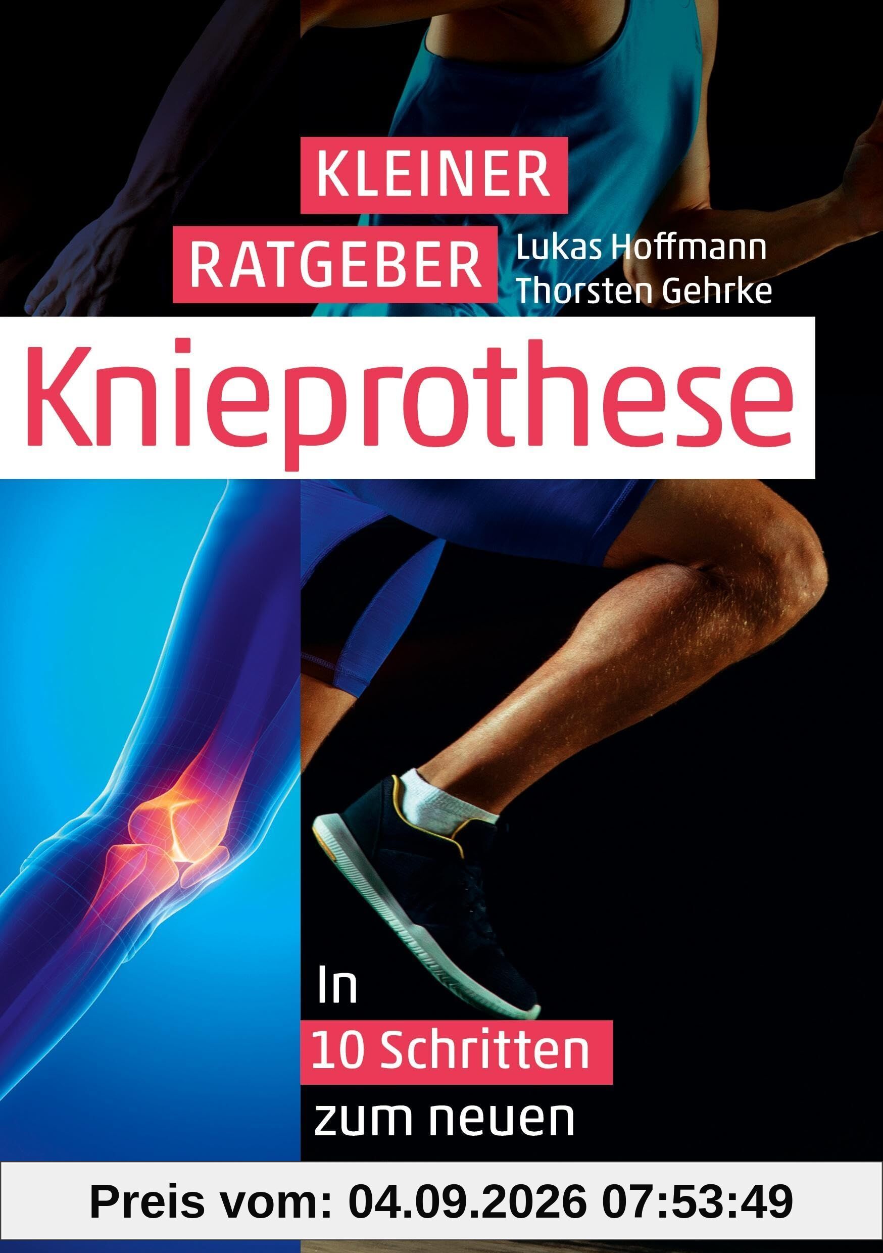 Kleiner Ratgeber Knieprothese: In 10 Schritten zum neuen Knie
