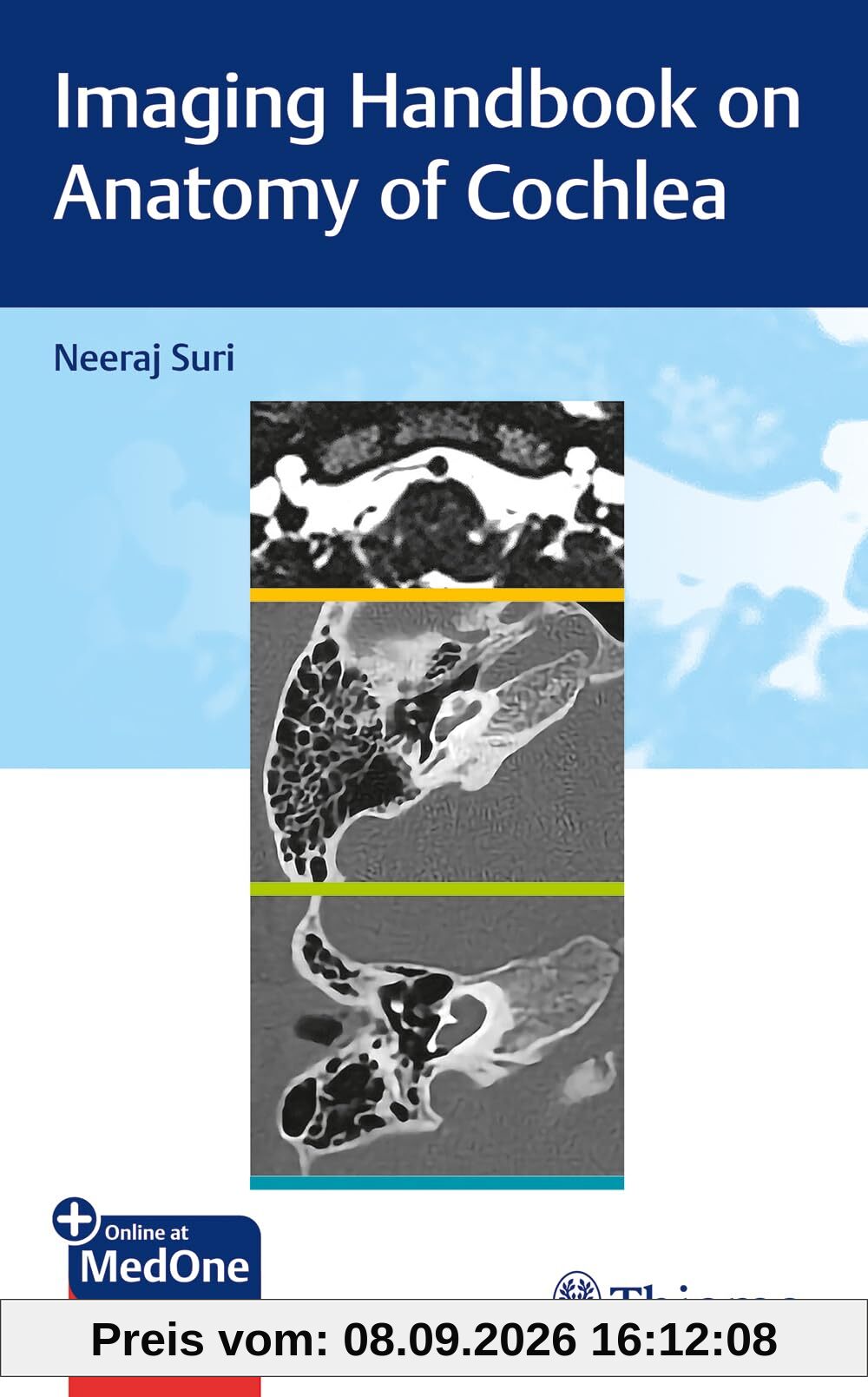 Imaging Handbook on Anatomy of Cochlea