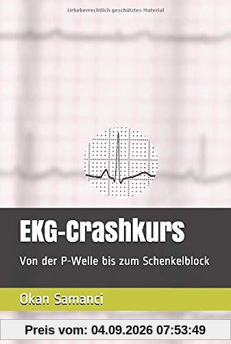 EKG-Crashkurs: Von der P-Welle bis zum Schenkelblock
