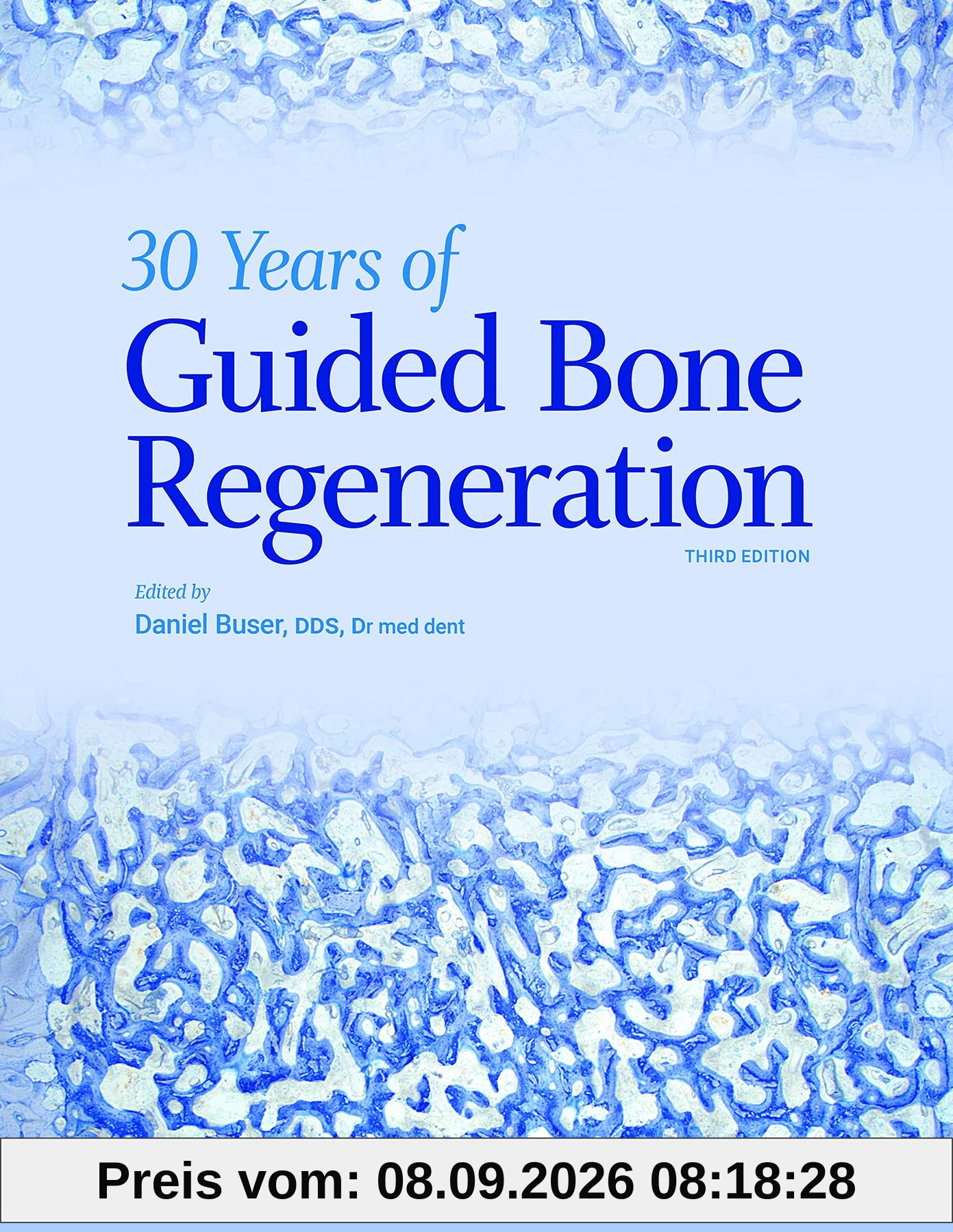 30 Years of Guided Bone Regeneration