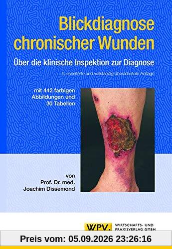 Blickdiagnose chronischer Wunden: Über die klinische Inspektion zur Diagnose