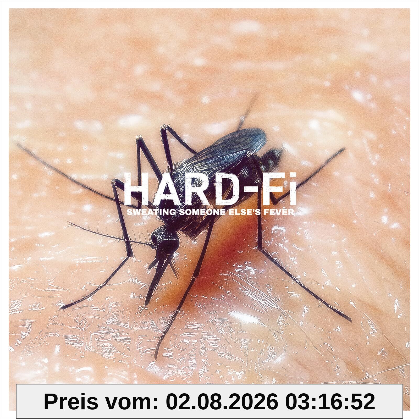Hard-Fi Sweating Someone Else'S Fever