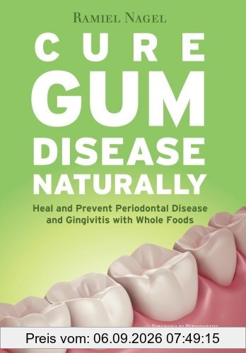 Cure Gum Disease Naturally: Heal Gingivitis and Periodontal Disease with Whole Foods